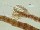 8 - Tricoblasti con spermatocisti